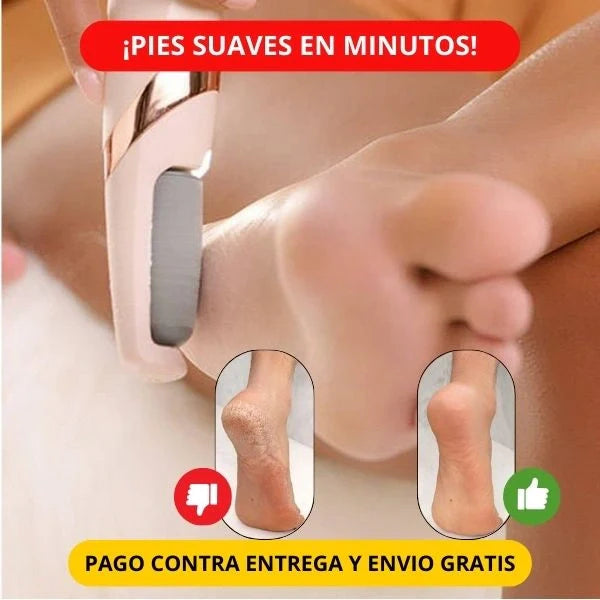REMOVEDOR DE CALLOS