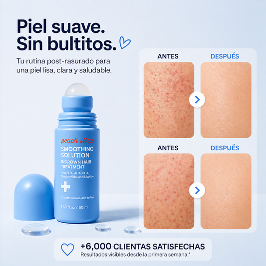 Solución para Vellos Encarnados – Piel Suave y Sin Bultitos desde la Primera Semana
